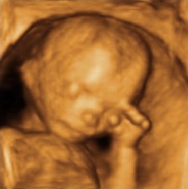 4D ultrasound image