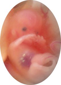 suparna sinha, CC BY-SA 2.0 <https://creativecommons.org/licenses/by-sa/2.0>, via Wikimedia Commons Unborn baby in the womb